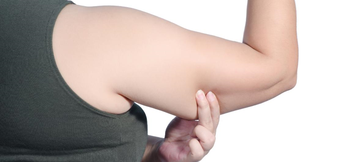 زيادة الوزن لدى النساء قد تؤدي لسلس البول